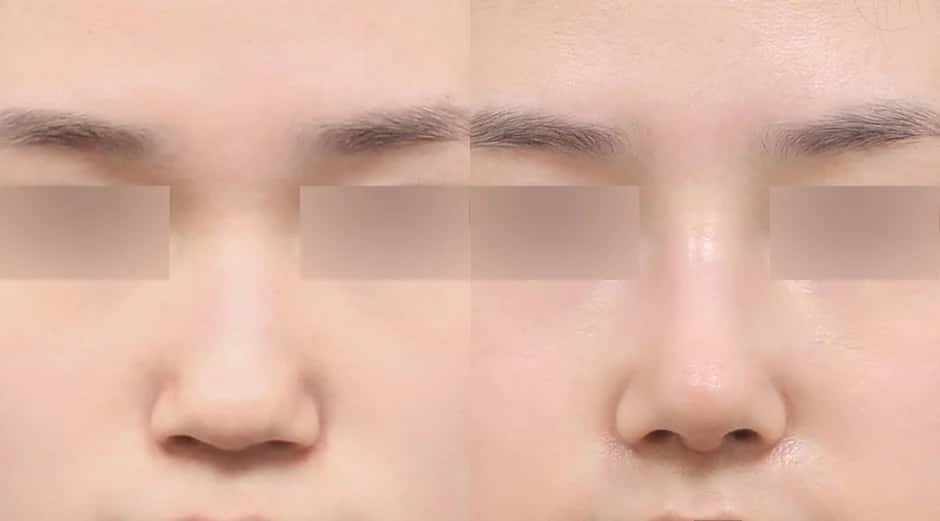 bannerImage