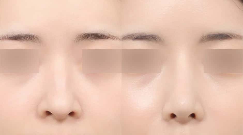 bannerImage
