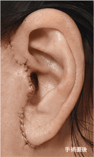 Skill matters in post-surgery scarring too. 2