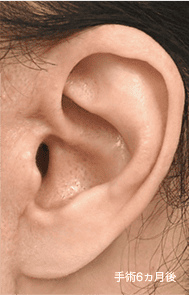 Skill matters in post-surgery scarring too. 3