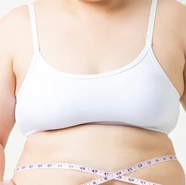 肥満性巨大乳房症