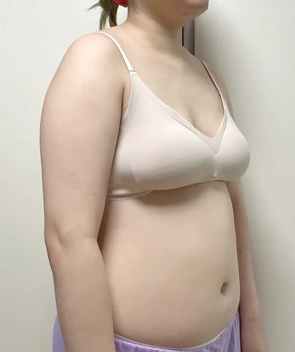 手術前