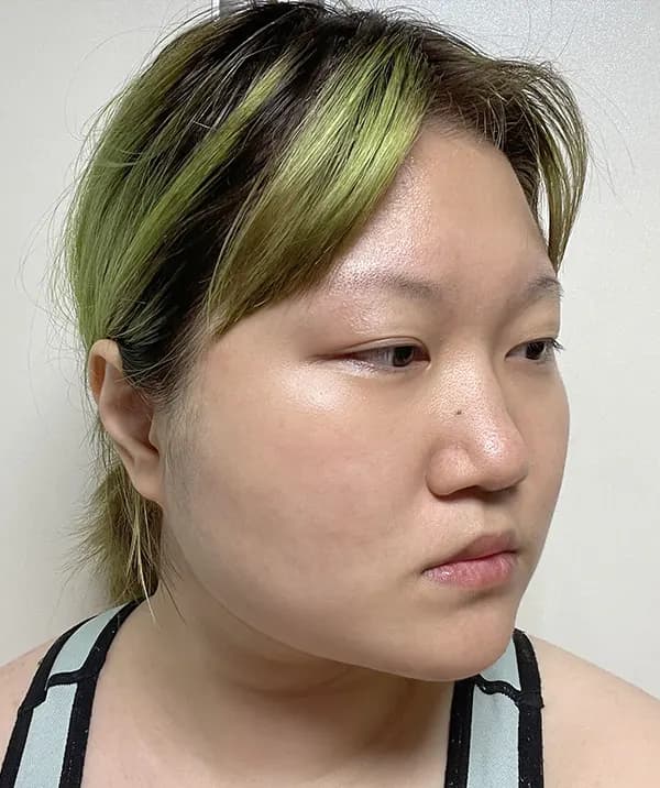 手術前