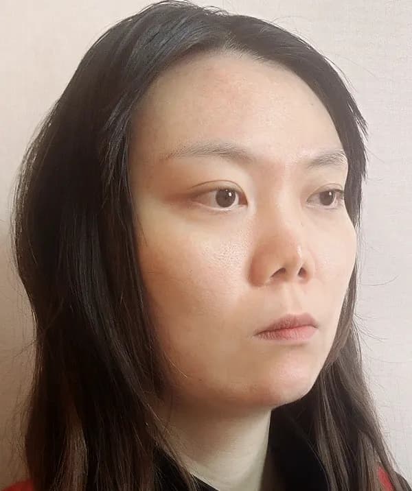 手術前