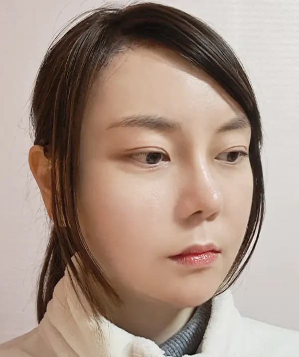 手術後60日目