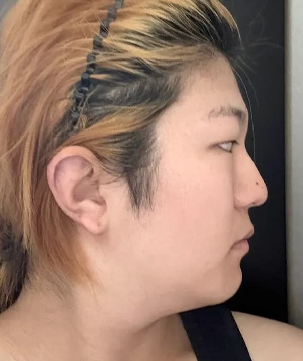 手術前