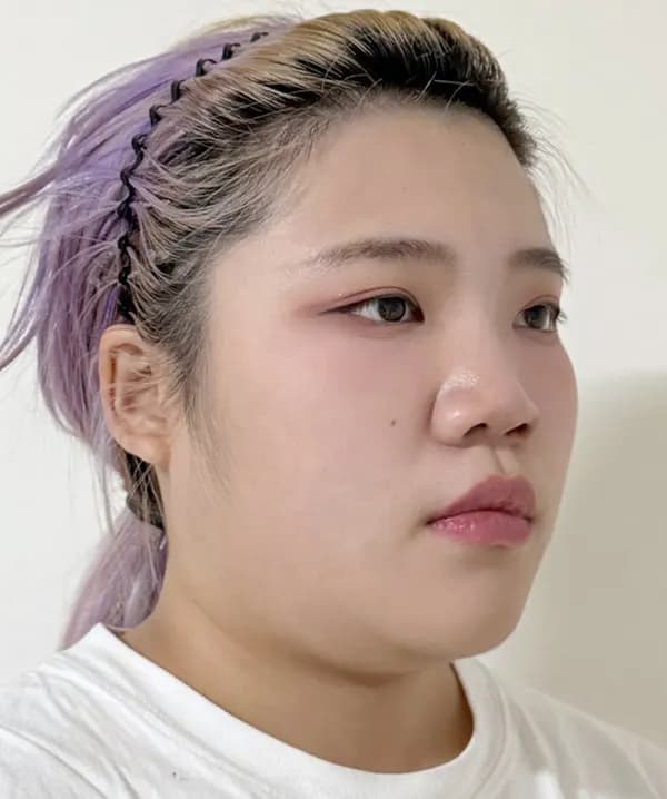 手術前