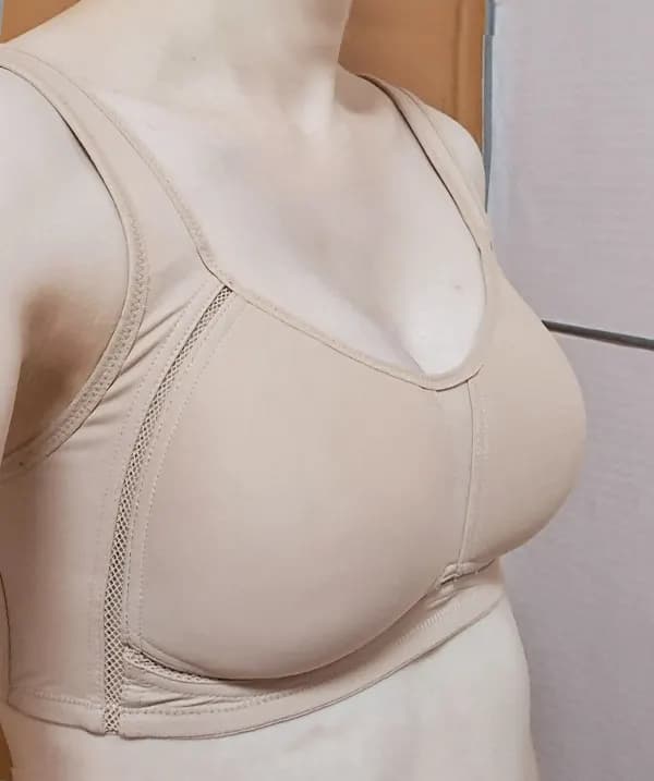 Before and after surgery front view