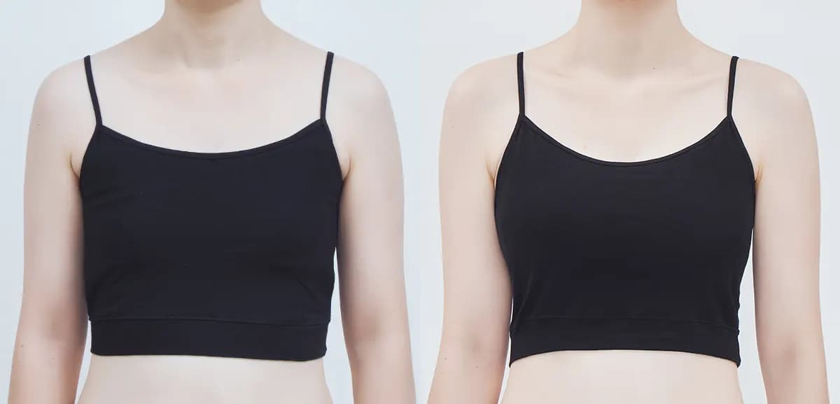 Before and after surgery