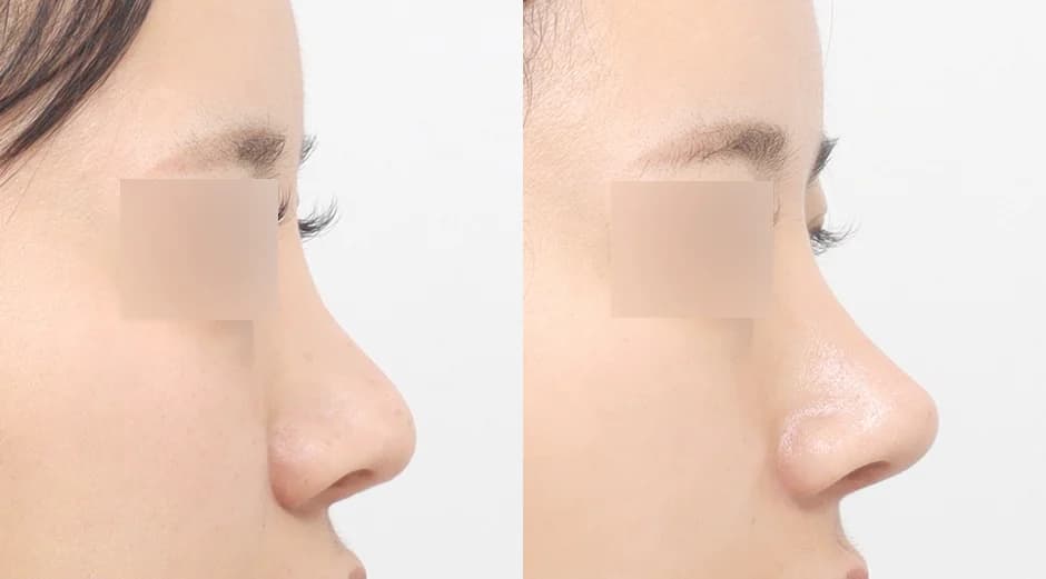AB Plastic Surgery