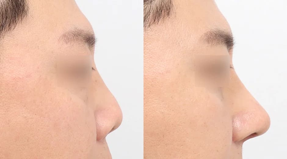 AB Plastic Surgery