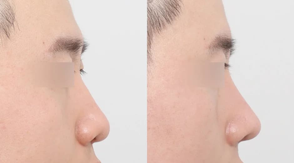 AB Plastic Surgery