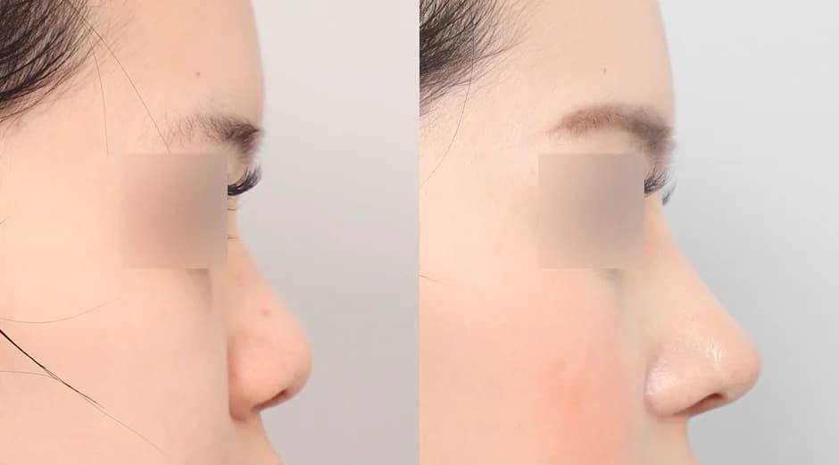 AB Plastic Surgery