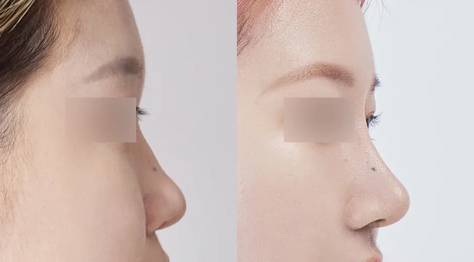 AB Plastic Surgery