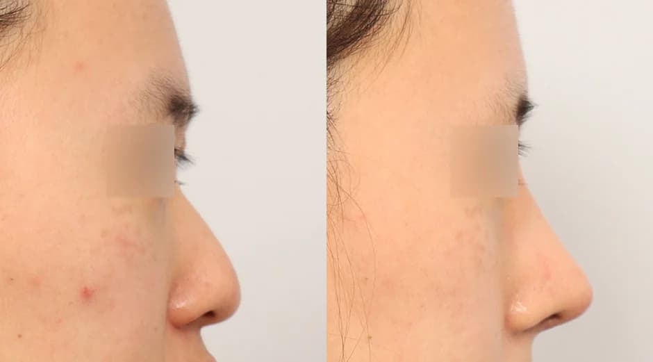 AB Plastic Surgery