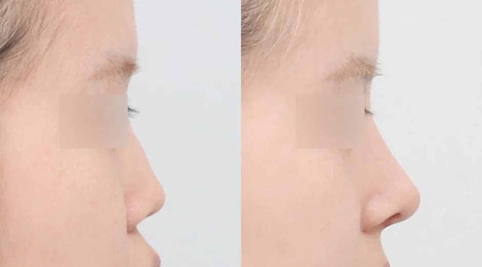 AB Plastic Surgery