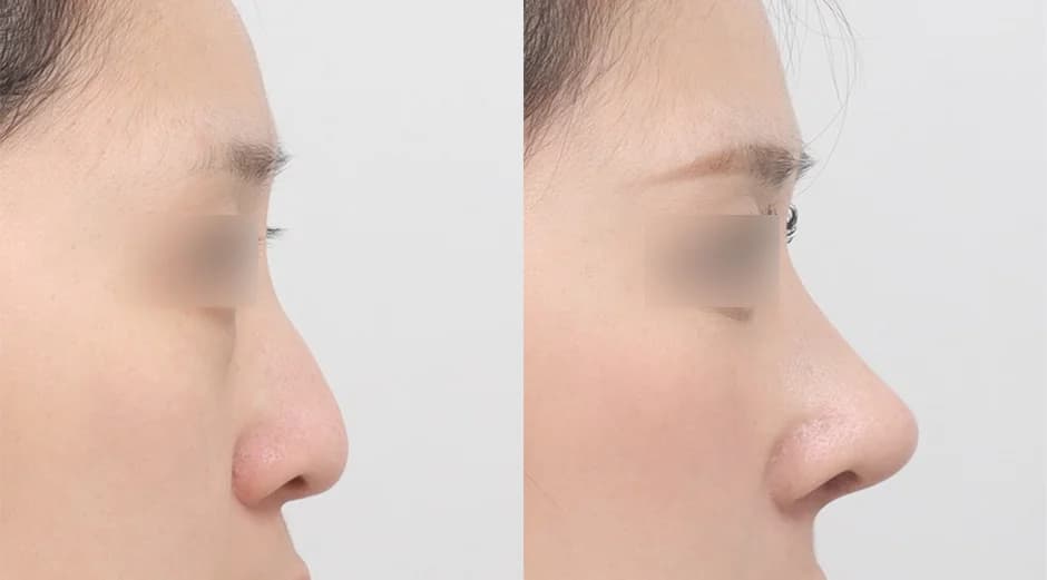 AB Plastic Surgery