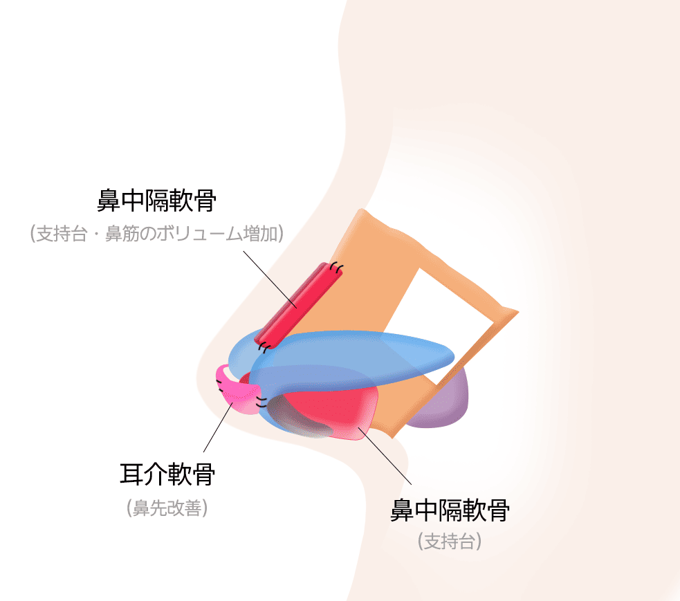 耳介軟骨・鼻中隔軟骨による形成