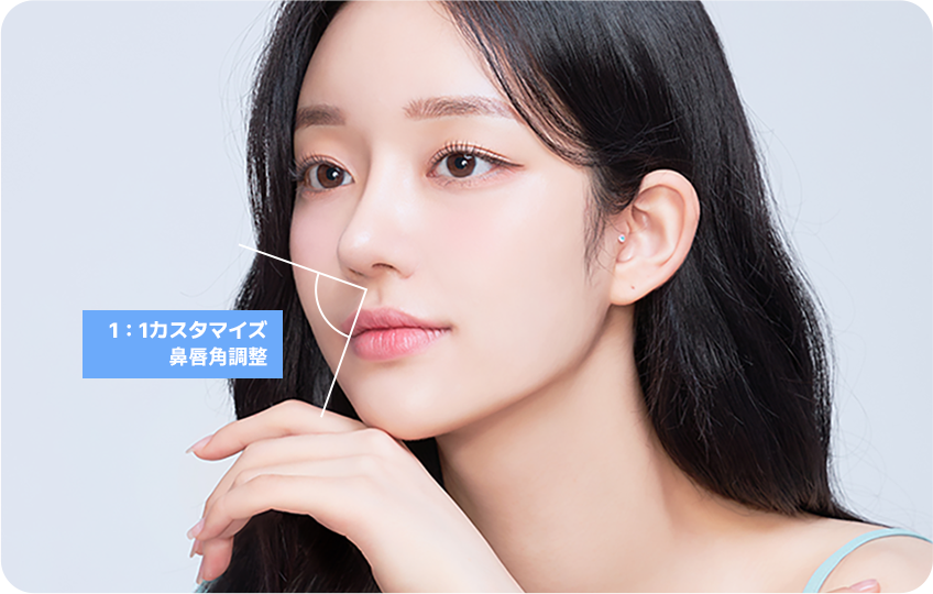 1:1 customized nasolabial angle