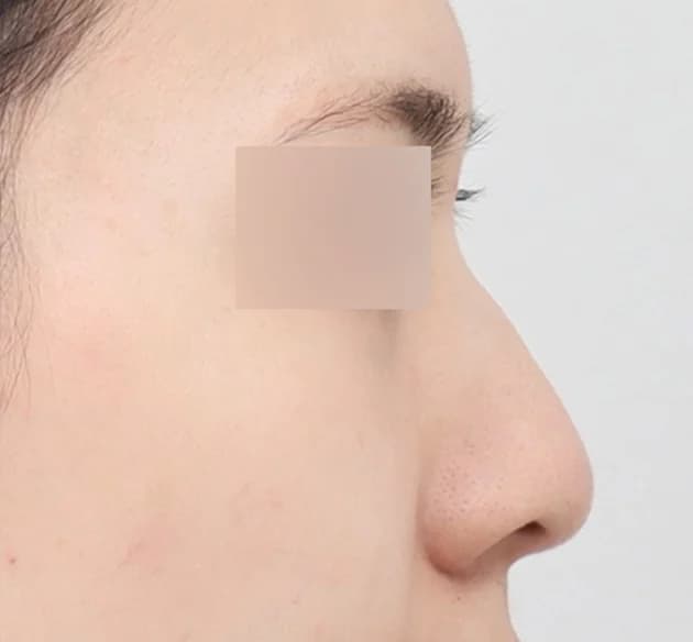 華やかな鼻先 before