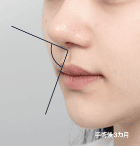 鼻柱と人中の角度が調和した美しい横顔