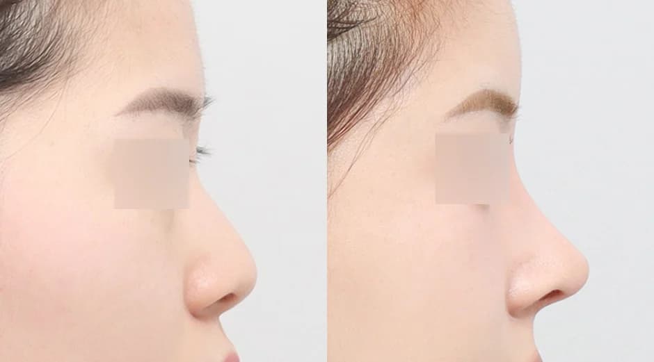 AB Plastic Surgery
