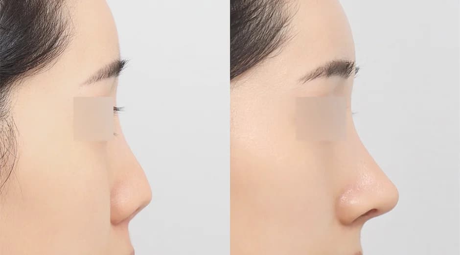 AB Plastic Surgery