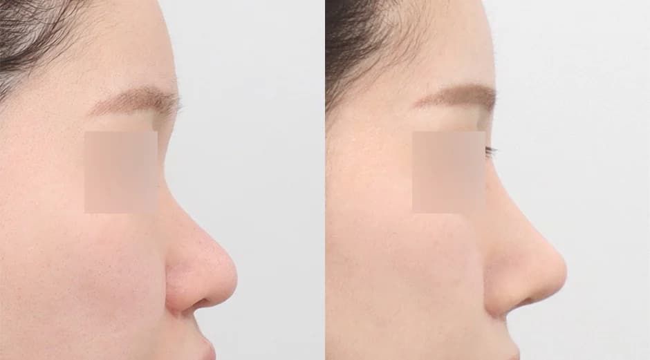 AB Plastic Surgery