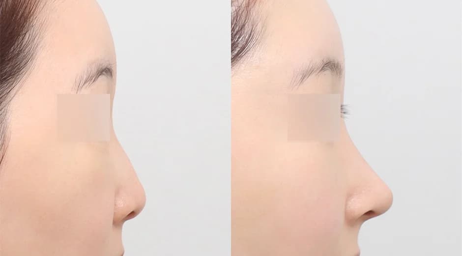 AB Plastic Surgery