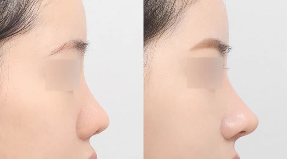 AB Plastic Surgery