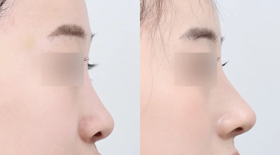 AB Plastic Surgery