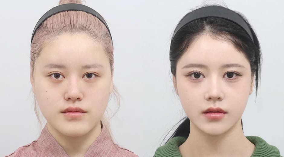 AB Plastic Surgery