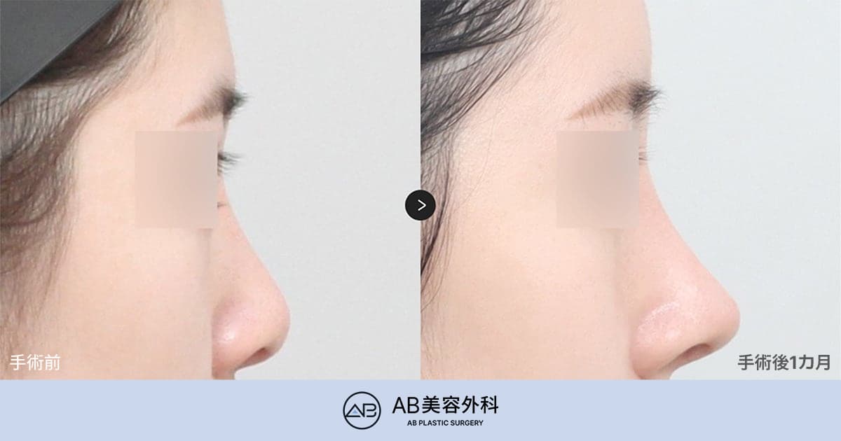 再手術が得意な病院はまずここをチェックしてみてください。