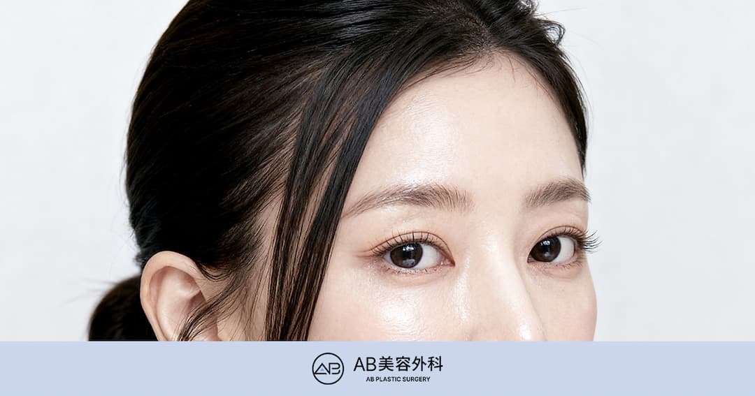 額リフトと眉下リフトの違いを徹底解説｜自分に合うのはどっち？