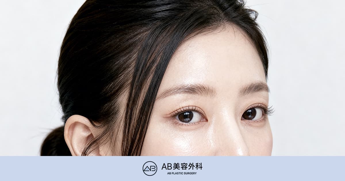 額リフトと眉下リフトの違いを徹底解説｜自分に合うのはどっち？