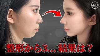 整形から3ヶ月…横顔が別人に！？ | AB美容整形