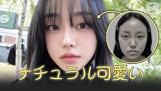 抜け感かわいい顔に大変身 | AB美容整形