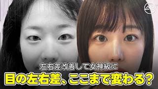目の左右差、ここまで変わる❣