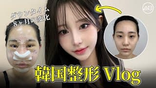 韓国整形ダウンタイム8ヶ月の変化を公開 | AB美容整形