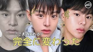 これ、同一人物って信じる？ | AB美容整形