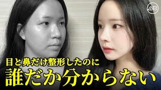 たった3つの手術で別人レベルの変化！ | AB美容整形