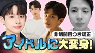  【AB整形外科/非切開目つき矯正】この手術受けても大丈夫？#韓国整形