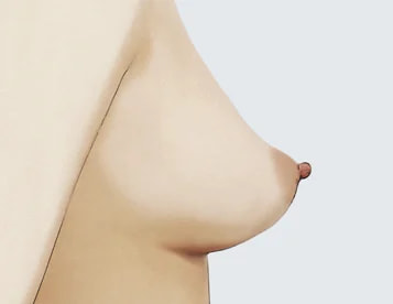 その他 特異なバストの形