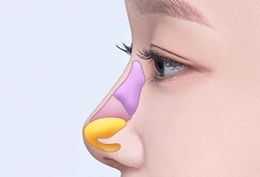 Short nose surgery — before: nasal structure