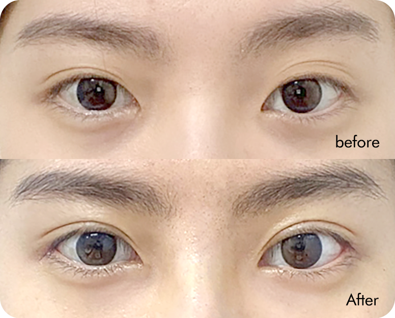 AB plastic surgery