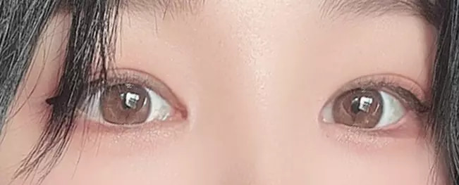 Long lasting before after case 8