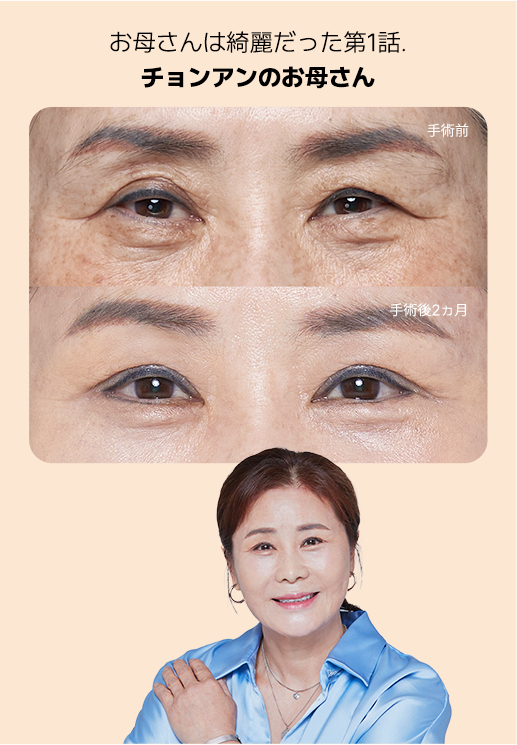 Beauty Moms Episode 7 makeover case