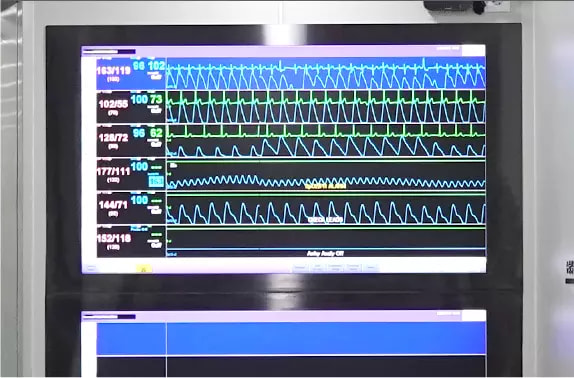 中央感知システム