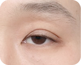 The Key to Beautiful Eyes