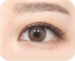 眼瞼下垂がある場合